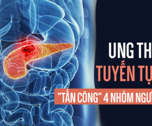 Ung thư tụy rất nguy hiểm vì khó chữa, ai có 4 đặc điểm này hãy đặc biệt cẩn thận