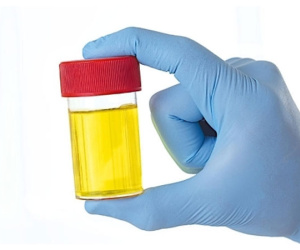 Xem nước tiểu đoán tuổi thọ con người