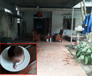 Thanh Hoá: Cận cảnh 'sọ dừa' do bò đẻ gây xôn xao dư luận