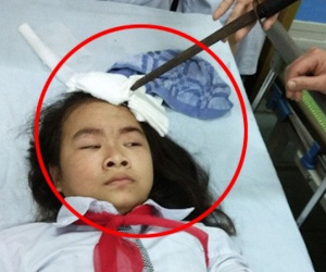Hà Nam: Nữ sinh bị bạn phi dao trúng người, Bộ yêu cầu xác minh