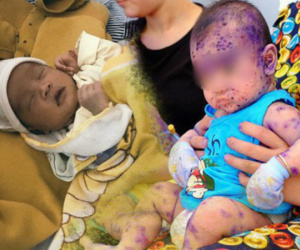 Đau lòng trước những hậu quả trẻ sơ sinh gánh phải khi người lớn cuồng phương pháp 'thuận tự nhiên'