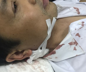 Cầm dao bầu xông vào trụ sở chém trọng thương CSGT