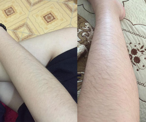 Chùm ảnh: Còn gì khổ hơn những cô nàng phận là con gái nhưng lông mọc còn rậm hơn con trai