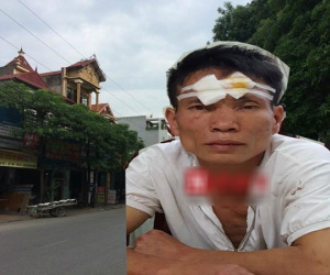 Ảnh minh họa