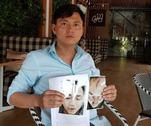 Hà Nam: Trên đường đưa con đi khám bệnh, ông bố bị 2 thanh niên hành hung