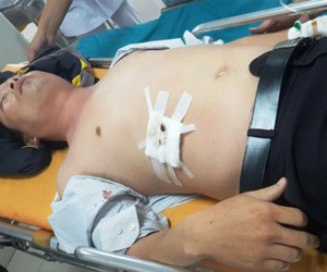 Lớp trưởng đâm thầy chủ nhiệm trọng thương vì xăm hình 'cái môi con gái'