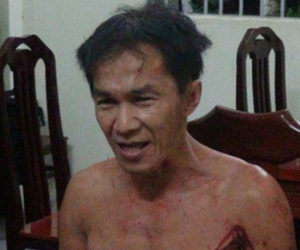 Bắt nghi phạm chém lìa đầu nạn nhân, chém luôn công an