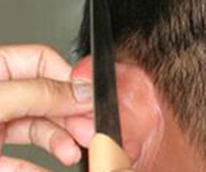 Cô gái bị chích điện, cắt vành tai vì trả nợ chậm