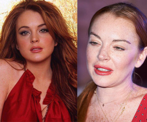Lindsay Lohan: Ngôi sao nghiện phẫu thuật thẩm mỹ và già cỗi ở tuổi 32