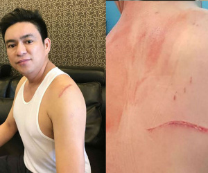 Bắt nhóm giang hồ truy sát bác sĩ Chiêm Quốc Thái ở trung tâm TP.HCM