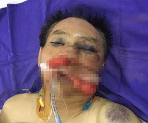 Nguyên đại tá công an đánh vợ chồng anh trai giập phổi
