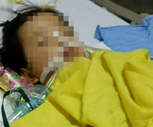 Bé gái 20 tháng tuổi bị rạn hộp sọ, hôn mê sâu, liệt nửa người sau khi đến trường mầm non 3 ngày