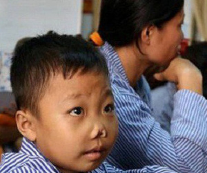 12 triệu người Việt mang gen căn bệnh phải điều trị cả đời, tốn tiền tỷ: Bộ Y tế nói gì?