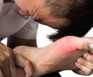 Mẹo giảm đau nhức cho người bệnh gút