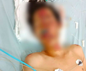 Nam thanh niên 17 tuổi nhập viện sau cuộc rượt đuổi của CSGT