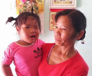 Thanh Hóa: Cô giáo đánh vào đầu khiến bé 3 tuổi méo miệng?