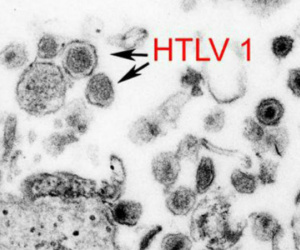 Virus cổ xưa có 'họ hàng với HIV' đột nhiên trỗi dậy