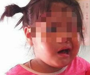 Cô giáo bị tố đánh trẻ liệt dây thần kinh, méo mồm tạm nghỉ việc