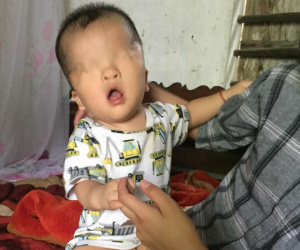 Số phận nghiệt ngã và khát vọng nhìn thấy ánh sáng của bé trai sinh ra không có đôi mắt