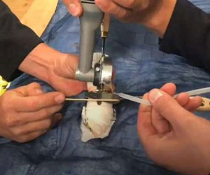 Lính cứu hỏa Đức luyện giải cứu 'của quý' kẹt trong nhẫn, cổ chai