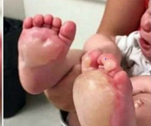 Phát hiện chân con có vết phồng rộp lớn, bà mẹ nghi ngờ nên báo cảnh sát và phát hiện ra sự thật rùng rợn về người trông trẻ
