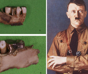 Phát hiện sự thật sốc về trùm phát xít Hitler qua bí mật trong hàm răng