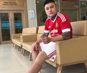 Những tai nạn kinh hoàng của sao Việt trên sân khấu