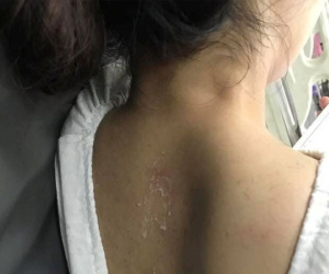 Hà Nội: Sự thật thông tin cô gái nghi bị mẹ chồng thuê người đổ keo 502 khắp đầu