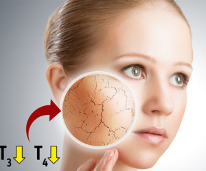 10 dấu hiệu tuyến giáp của bạn không hoạt động đúng