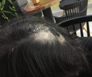 Mẹ chồng lên tiếng về nghi vấn đổ keo 502 lên đầu con dâu cũ