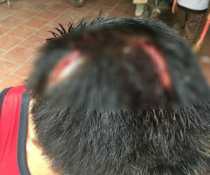 Người đàn ông bị 2 kẻ côn đồ bắt quỳ lạy, dùng hung khí đánh dã man ở Bắc Giang