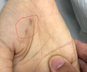 Cái chết oan uổng của nữ bác sĩ thú y bị chó dại cắn