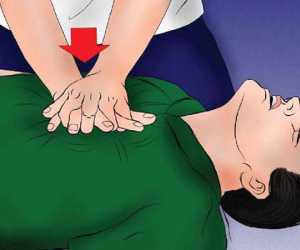 Hồi sinh một người bị ngưng tim như thế nào