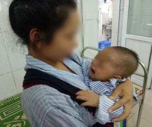Mẹ vắt sữa chữa đỏ mắt cho con, bé trai 7 tháng tuổi phải bỏ một mắt vì hoại tử