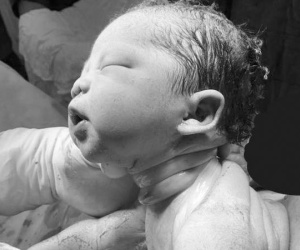 Bé Sài Gòn chào đời với dây rốn quấn chặt cổ: Các mẹ hốt hoảng, bác sĩ bảo 'chuyện thường'