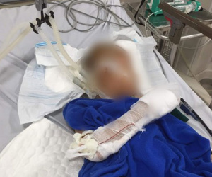 Nam thanh niên nghi ngáo đá chém bé trai 9 tuổi lún hộp sọ rồi dùng dao cứa cổ mình trước khi nhảy sông tự tử