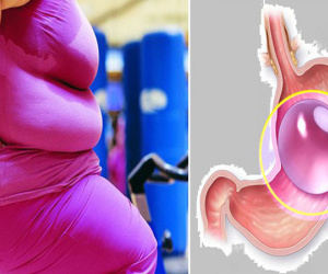 12 người đã tử vong sau khi thử cách giảm cân phổ biến này: Đây là những gì bạn nên biết để tránh
