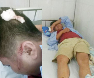 Bắt tạm giam tài xế ô tô khách đánh bất tỉnh người bố để con nôn ra xe