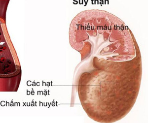 Cụ bà 'nôn thốc nôn tháo' vì ăn dứa mỗi ngày, loại quả này không phải ai cũng ăn được