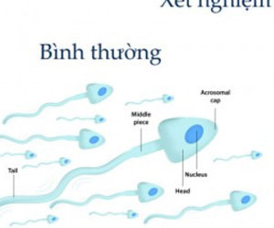 Mãn dục nam - Hiểu để ứng phó phù hợp
