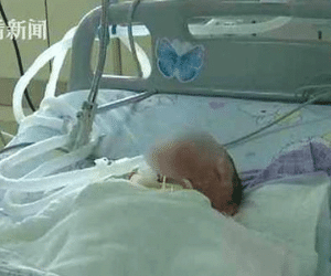 Mẹ mải buôn chuyện với bạn không để ý, con đùa nghịch lao đầu vào nồi lẩu sôi sùng sục