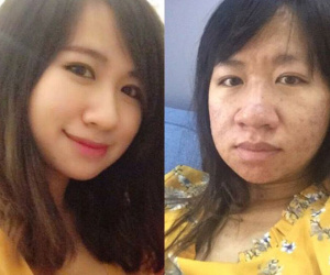 Chia sẻ hình ảnh trước và sau khi có thai với dung nhan một trời một vực, chị gái này đã chứng minh: Phụ nữ xấu nhất lúc mang bầu!