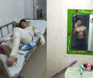 Hành trình phục hồi từ cơ thể bị bỏng nặng 40% đến body cơ bắp khỏe mạnh của chàng trai Thái Nguyên