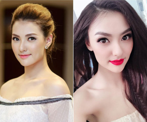 Hồng Quế nói gì trước nghi vấn gương mặt nhọn bất thường vì dao kéo?