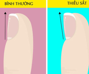Hãy nhìn xuống đôi chân mình và xem nó đang cảnh báo bạn những vấn đề gì về sức khỏe