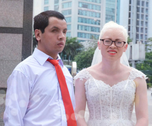 Chuyện tình cảm động phía sau đám cưới của chú rể khiếm thị và cô dâu đột biến gen có mái tóc bạc trắng ở Hà Nội