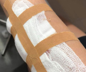 Hà Nội: Xôn xao thông tin cảnh báo của cô gái trẻ bị tên cướp rạch tay, giật túi xách