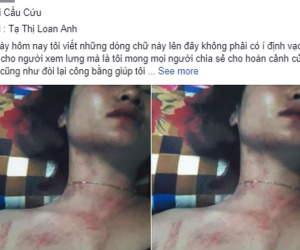 Tình tiết bất ngờ vụ vợ lên FB tố bị bạo hành: Người chồng khẳng định tất cả chỉ là chiêu trò của vợ