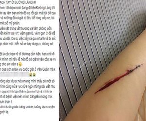 Tự dùng dao lam rạch tay, dựng chuyện bị cướp ở đường Láng