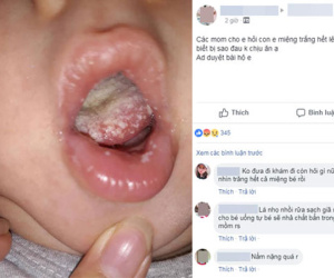 Con có bệnh trong miệng, đau không chịu ăn, mẹ bị mắng tới tấp vì không đưa đi khám còn lên Facebook hỏi 'các mẹ ơi'